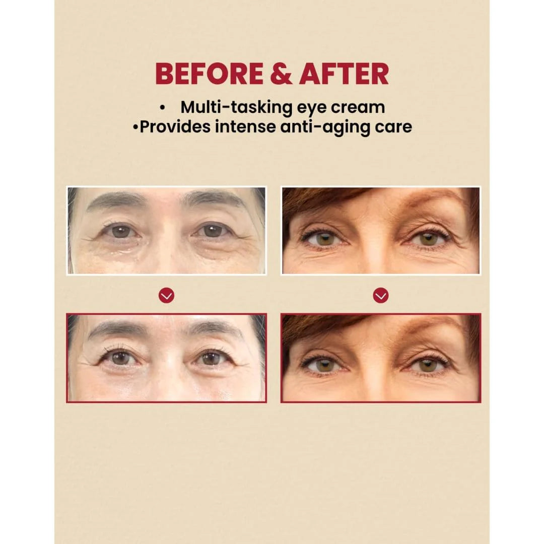 KSECRET Seoul 1988 Eye Cream Retinal Liposome 4% + Fermented Bean 30ml