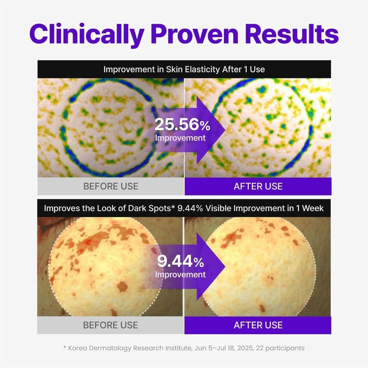CENTELLIAN24 Expert Madeca Cream Active Renew PDRN packaging detail