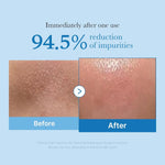 MEDICUBE Zero Pore Deep Cleansing Oil 205ml in use