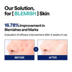 MEDIHEAL Madecassoside Pad used on irritated skin
