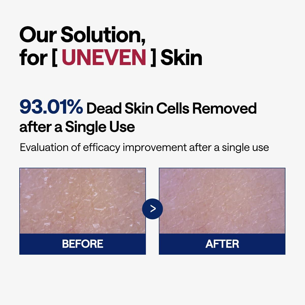 MEDIHEAL Phyto-enzyme Peeling Pad buffing across the face
