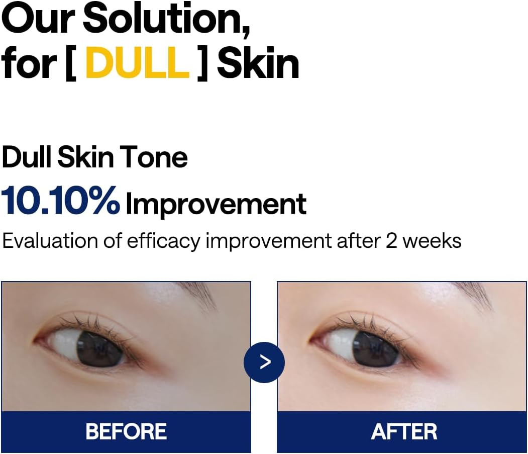 MEDIHEAL Vitamide Brightening Pad brightening result