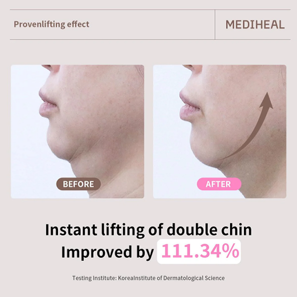 MEDIHEAL Retinol Collagen Ampoule Lifting Mask