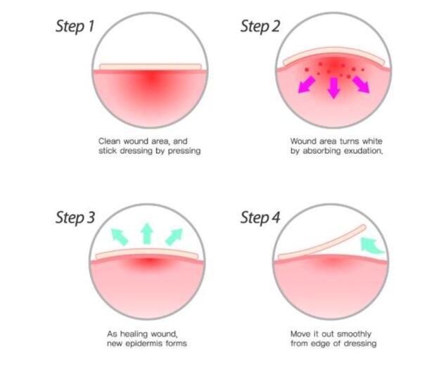 LUNE & BE Spot Patch 44pcs